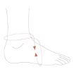 Picture of OTTOBOCK ELASTIC ANKLE SUPPORT