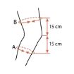 Picture of OTTOBOCK GENU CAREZZA PATELLA