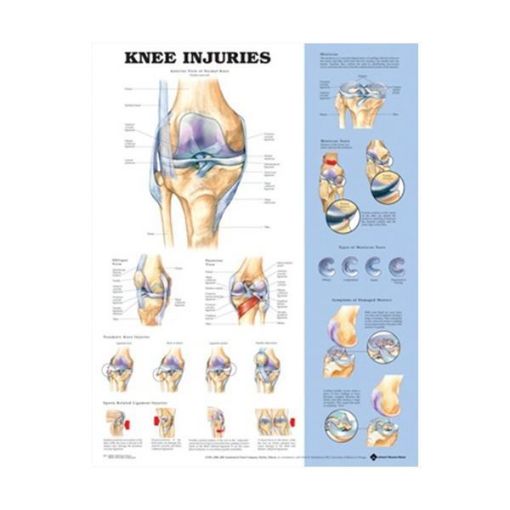 Picture of KNEE INJURIES CHART