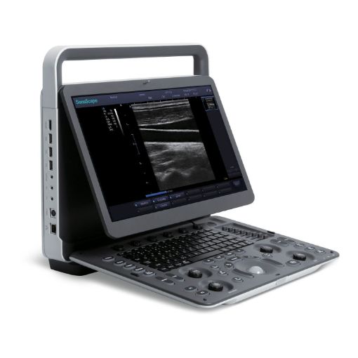 Picture of SONOSCAPE E1 ULTRASOUND UNIT