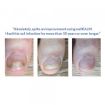 NAILKALM LOTION