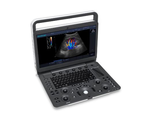 Picture of SONOSCAPE E2 PRO COLOUR ULTRASOUND UNIT