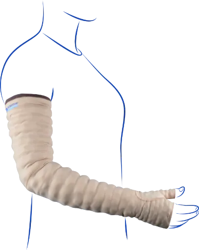 MOBIDERM ARMSLEEVE WITH MITTEN WITH THUMB