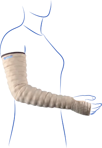 MOBIDERM ARMSLEEVE WITH MITTEN WITHOUT THUMB
