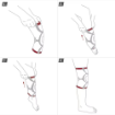 Picture of ACTIMOVE GENUMOTION KNEE SUPPORT