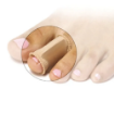 Picture of Gel Toe Spreaders with Tube