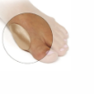 Picture of Gel Bunion Button
